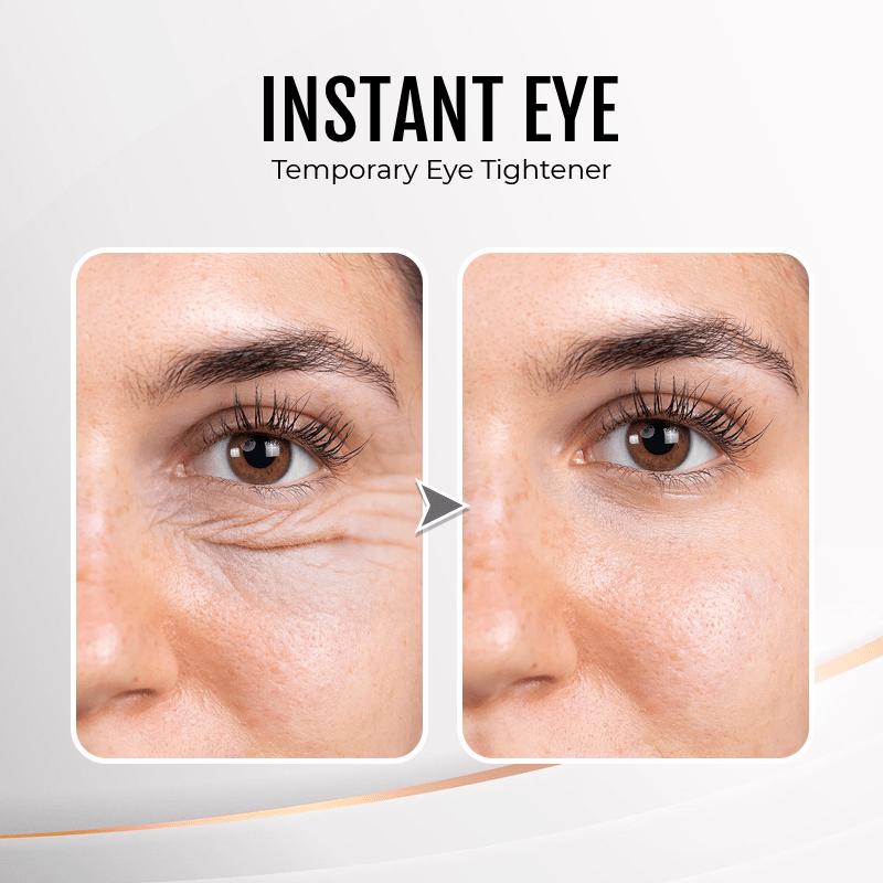 (🔥LAST DAY SALE - 80% OFF) YouthfulLift Eye Firming Cream