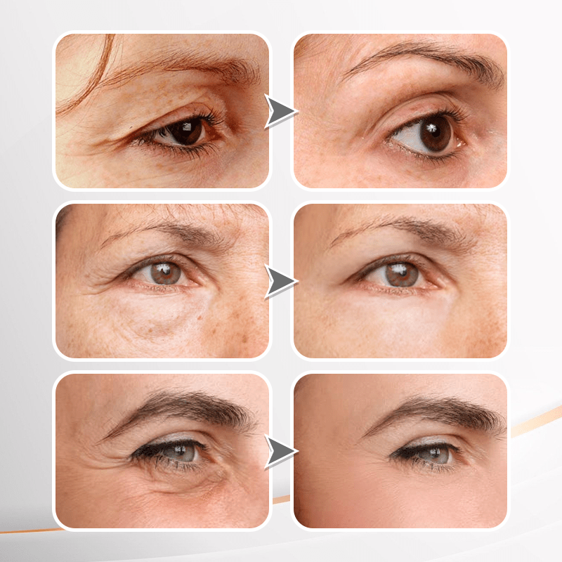 (🔥LAST DAY SALE - 80% OFF) YouthfulLift Eye Firming Cream