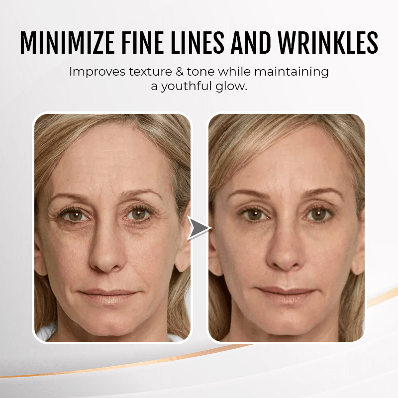 (🔥LAST DAY SALE - 80% OFF) YouthfulLift Eye Firming Cream