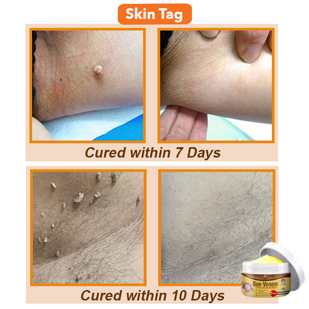 🐝Bee-Venom Comprehensive Cream 🇺🇸 Dermatologist Recommended
