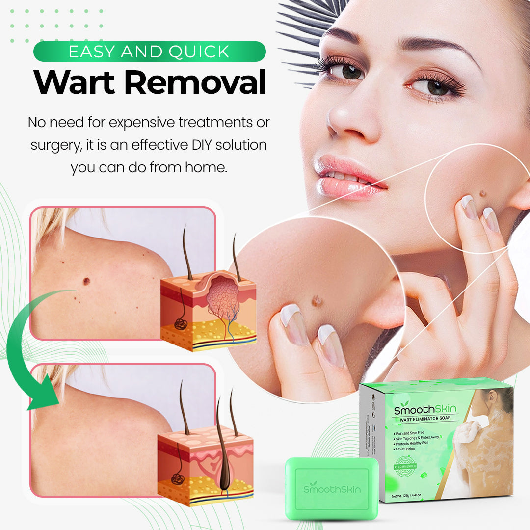 🎁Last Day Promotion 40% OFF - SmoothSkin™ Wart Eliminator Soap