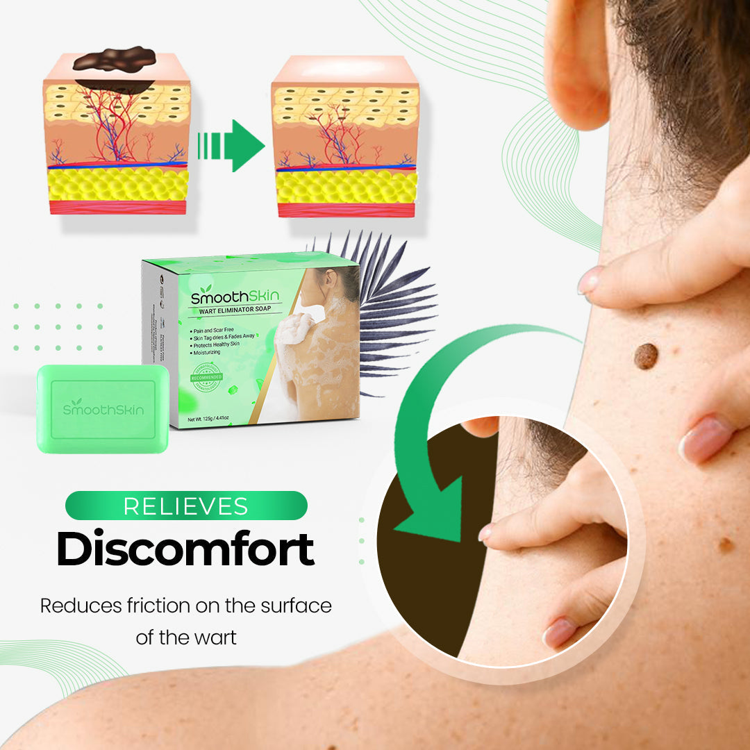 🎁Last Day Promotion 40% OFF - SmoothSkin™ Wart Eliminator Soap