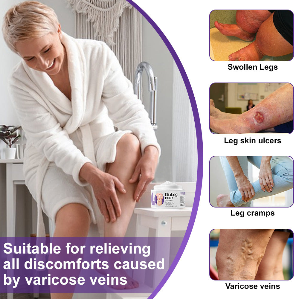 🏆✅𝐍𝐇𝐒-𝐀𝐏𝐏𝐑𝐎𝐕𝐄𝐃 - ODEIUN™𝐃𝐢𝐚𝐋𝐞𝐠 𝐂𝐚𝐫𝐞 𝐏𝐡𝐲𝐭𝐨 𝐂𝐫𝐞𝐚𝐦 - Helps Treat Varicose Veins, Swelling, Cramps, and Leg Pain