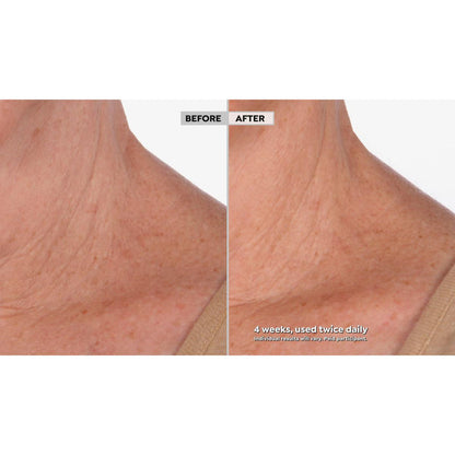 Neck Amour Leave-On Neck Mask