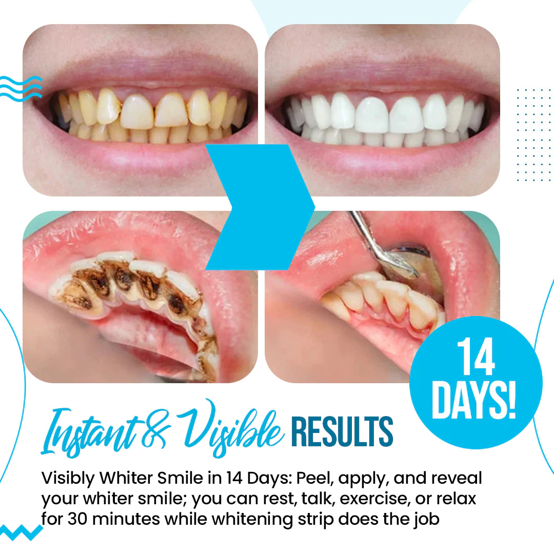 Professional Teeth Whitening Strips