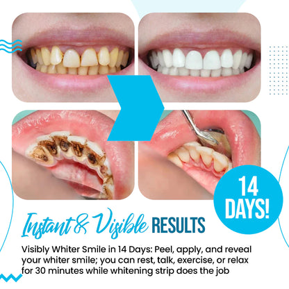 Professional Teeth Whitening Strips