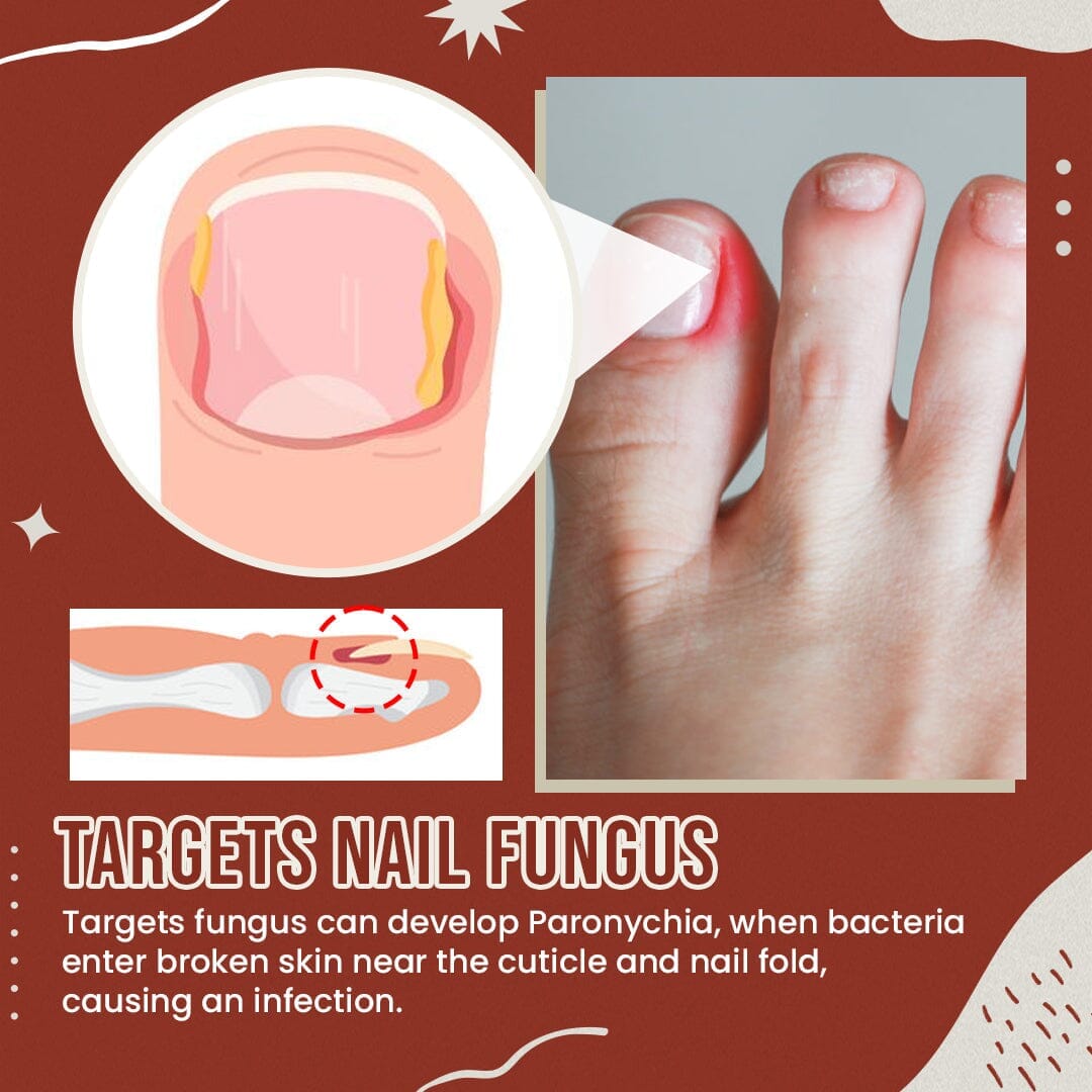 Funguardian™ Foot Fungus Socks