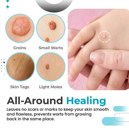 WartZap™ Skin Tag & Wart Remover Pen