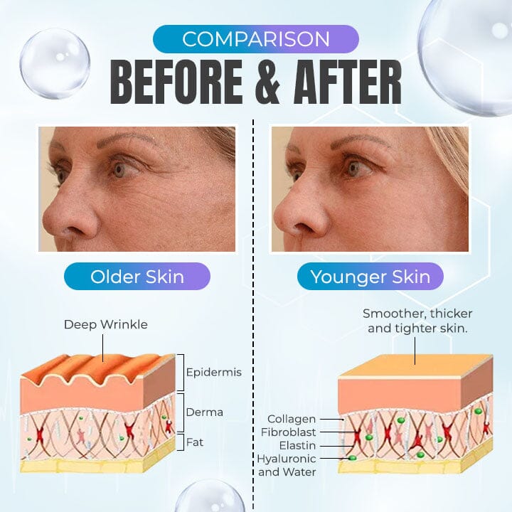 EELHOE™ Collagen Boost Anti-Aging Serum